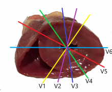 Chest Leads Illustration