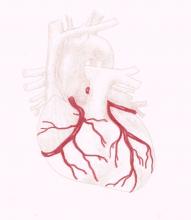 Coronary Arteries, Anterior View  FREE DOWNLOAD