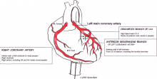 Coronary arteries labeled