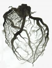 Coronary Vessels Fine Art Drawing, Alyssa Bean