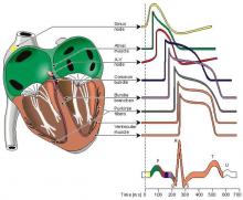 ECG Waveform, Action Potential