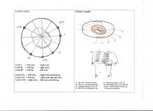 Frontal and Horizontal Plane Leads; Limb Leads and Chest Leads Diagrams