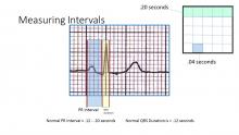 Measuring Intervals Illustration