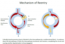 Reentry Circuit Illustration