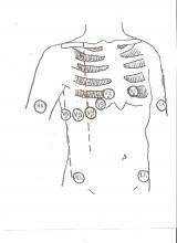 Right chest leads illustration