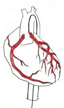 Free Download Image Coronary Arteries. Wire accessing LCA