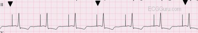 conduction examples