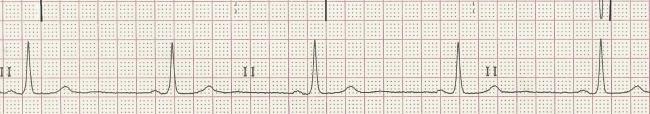 Rhythm Strip Ecg Guru Instructor Resources